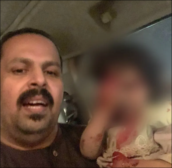 طفلة تسقط من سيارة والدها في الرياض